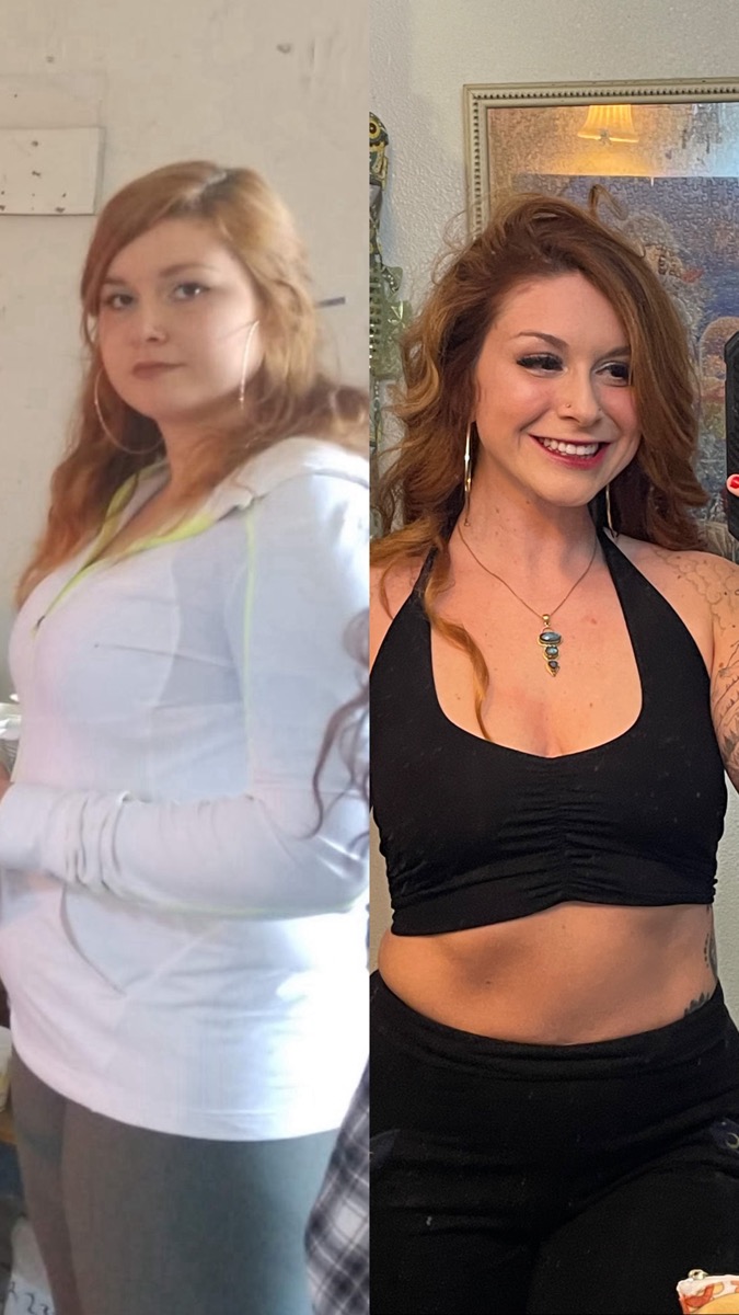 Amber before her wellness transformation, marking the start of her 10-year holistic healing journey
